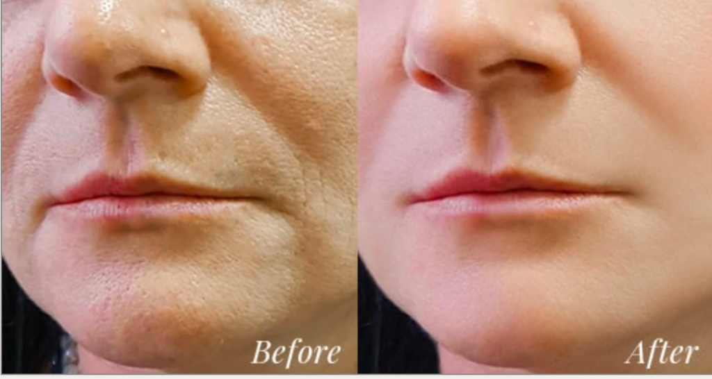 All Things BEAUTY & COSMETICS, Older appearing face before next to youthful appearance after.
